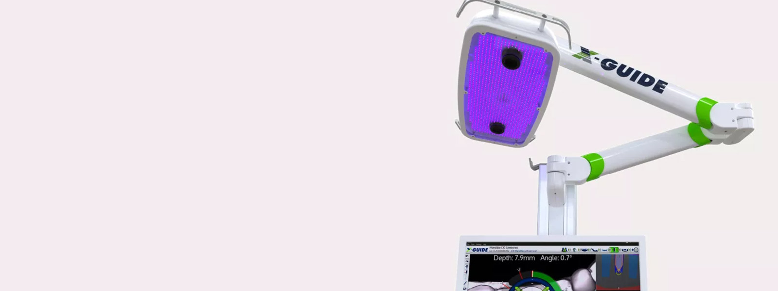 X-guide system.