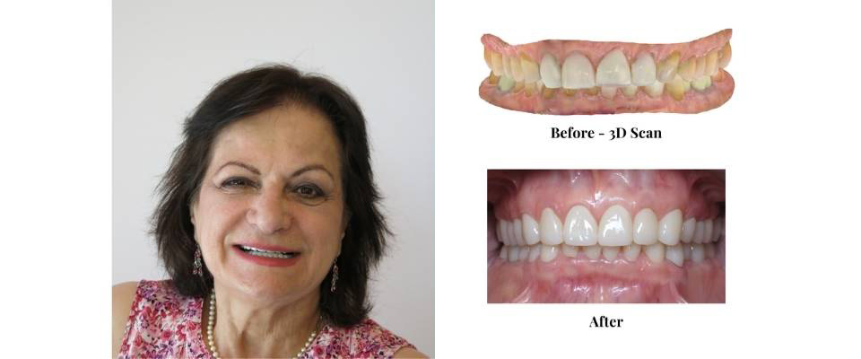 Smile Makeover Case (6)
